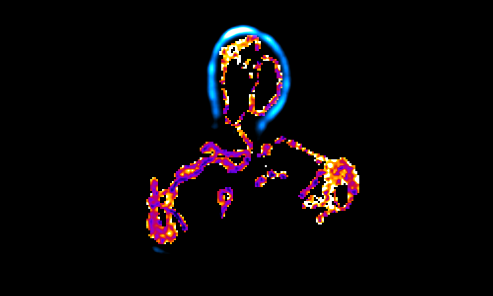 Fluorescent image of a heteroplasmic yeast zygote. Ratiometric imaging of the mitochondrial membrane potential. Image taken by Felix Thoma. Osman Lab.