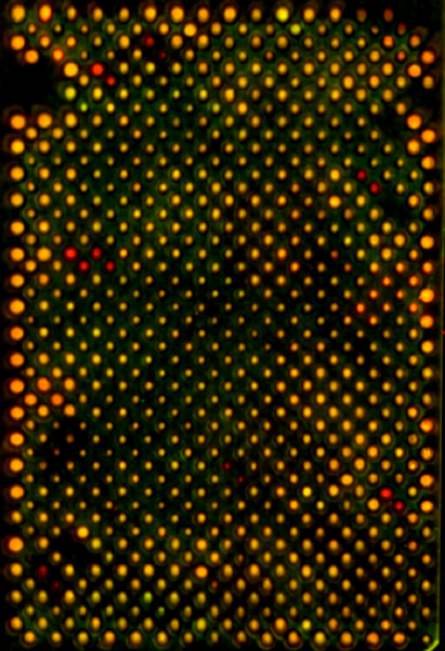 Image showing the result of a colony blot from a screen in S. cerevisiae for a screen for mutants involved in mtDNA copy number regulation. Image taken by Aylin Göke